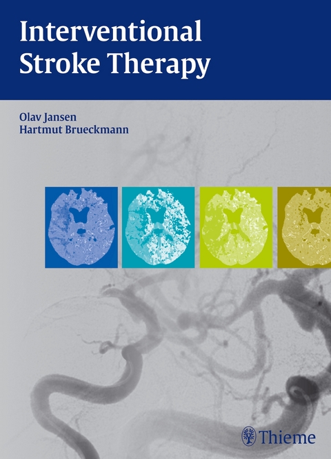 Interventional Stroke Therapy - Olav Jansen, Hartmut Brückmann