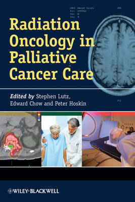 Radiation Oncology in Palliative Cancer Care - 