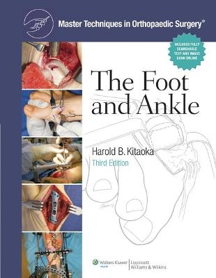 Master Techniques in Orthopaedic Surgery: The Foot and Ankle - Harold Kitaoka