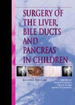 Surgery of the Liver, Bile-Ducts and Pancreas in Children, Second Edition