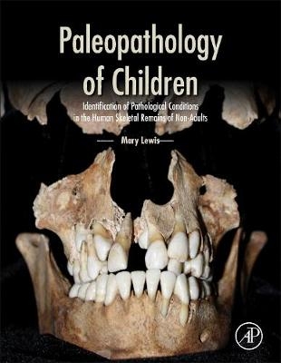 Paleopathology of Children - Mary Lewis