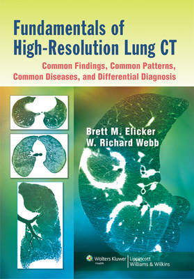 Fundamentals of High-Resolution Lung CT: Common Findings, Common Patterns, Common Diseases, and Differential Diagnosis - Brett M Elicker, W. Richard Webb