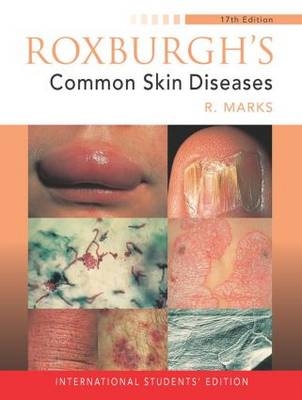 Roxburgh's Common Skin Diseases, 17Ed - Ronald Marks