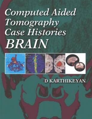 Computed Aided Tomography Case Histories: Brain - D Karthikeyan
