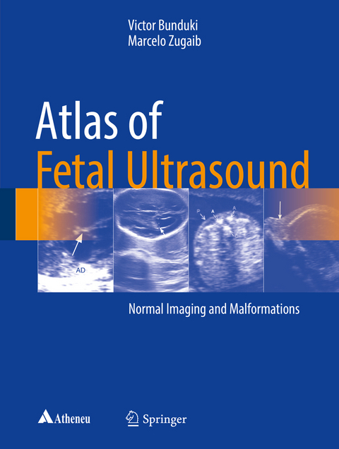Atlas of Fetal Ultrasound - Victor Bunduki, Marcelo Zugaib