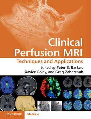 Clinical Perfusion MRI - 