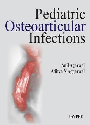 Pediatric Osteoarticular Infections - Anil Agarwal, Aditya N Aggarwal