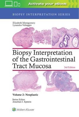 Biopsy Interpretation of the Gastrointestinal Tract Mucosa: Volume 2: Neoplastic - Elizabeth A. Montgomery, Lysandra Voltaggio