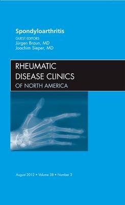 Spondyloarthropathies, An Issue of Rheumatic Disease Clinics - Juergen Braun, Joachim Sieper