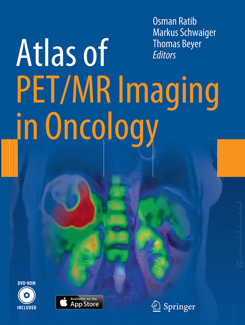 Atlas of PET/MR Imaging in Oncology - 