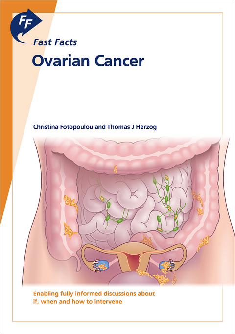 Fast Facts: Ovarian Cancer - Professor Christina Fotopoulou, Dr Thomas Herzog