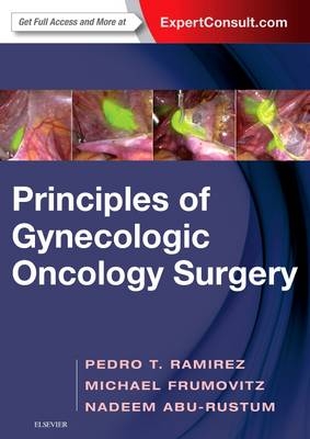 Principles of Gynecologic Oncology Surgery - Pedro T. Ramirez, Michael Frumovitz, Nadeem R. Abu-Rustum
