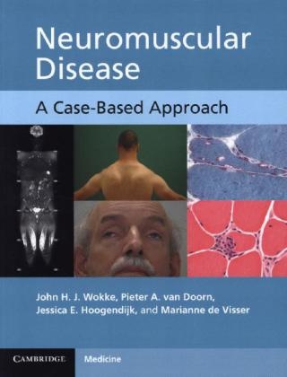 Neuromuscular Disease - John H. J. Wokke, Pieter A. van Doorn, Jessica E. Hoogendijk, Marianne de Visser