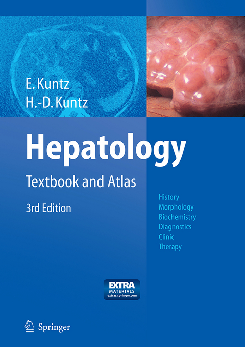Hepatology - Erwin Kuntz, Hans-Dieter Kuntz