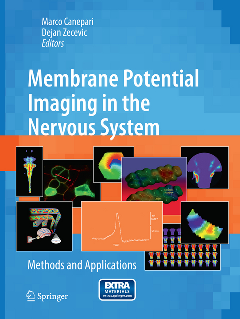 Membrane Potential Imaging in the Nervous System - 