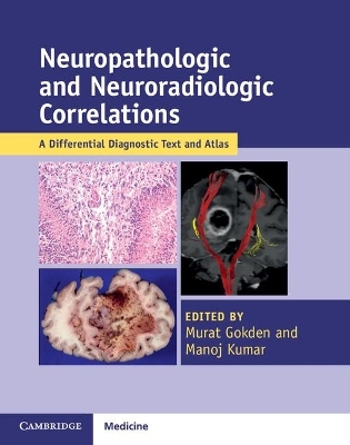 Neuropathologic and Neuroradiologic Correlations - 