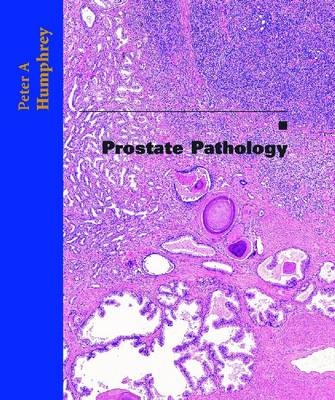 Prostate Pathology - Peter A. Humphrey