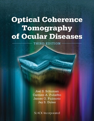 Optical Coherence Tomography of Ocular Diseases - Joel S. Schuman, Carmen Puliafito, James G. Fujimoto, Jay S. Duker