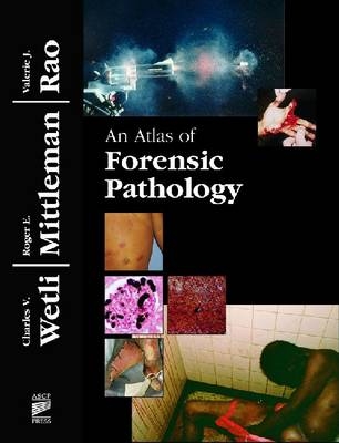 An Atlas of Forensic Pathology - Charles V. Wetli, Roger E. Mittleman, Valerie J. Rao