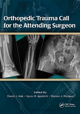 Orthopedic Trauma Call for the Attending Surgeon - David Hak, Kyros Ipaktchi, Steven Morgan