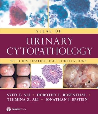 Atlas of Urinary Cytopathology - Syed Z. Ali, Dorothy L. Rosenthal, Tehmina Z. Ali, Jonathan I. Epstein