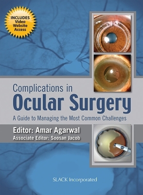 Complications in Ocular Surgery - Amar Agarwal