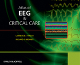 Atlas of EEG in Critical Care - 