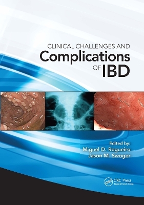 Clinical Challenges and Complications of IBD - Miguel Regueiro, Jason Swoger