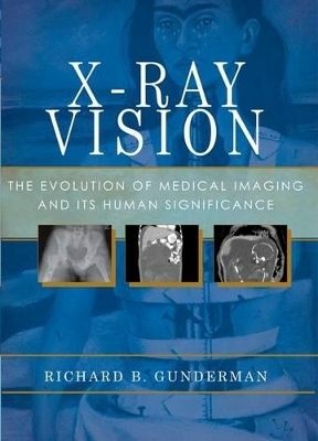 X-Ray Vision - Richard B. Gunderman