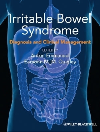 Irritable Bowel Syndrome: Diagnosis and Clinical Management - 