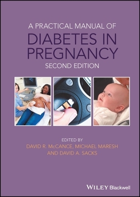 A Practical Manual of Diabetes in Pregnancy - 
