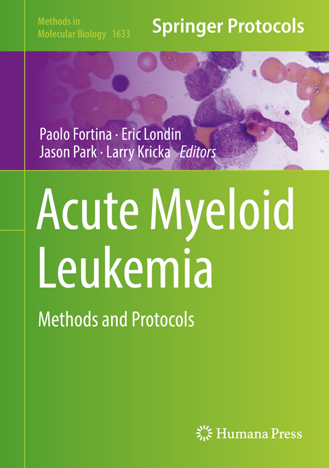 Acute Myeloid Leukemia - 