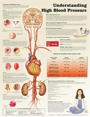 Understanding High Blood Pressure -  Anatomical Chart Company, Douglas S. Moodie