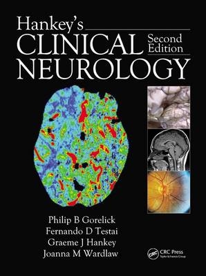 Hankey's Clinical Neurology - 