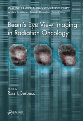 Beam's Eye View Imaging in Radiation Oncology - 