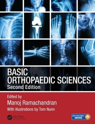 Basic Orthopaedic Sciences - 
