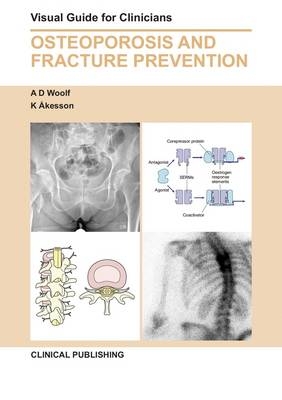 Osteoporosis and Fracture Prevention - 