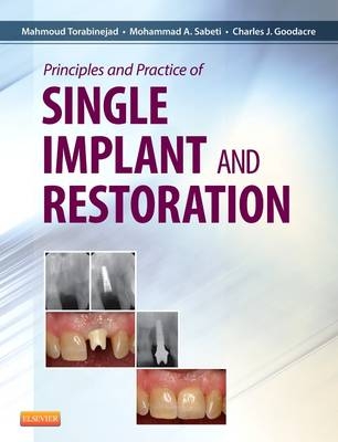 Principles and Practice of Single Implant and Restoration - Mahmoud Torabinejad, Mohammed Sabeti, Charles Goodacre
