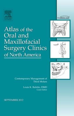 Contemporary Management of Third Molars, An Issue of Atlas of the Oral and Maxillofacial Surgery Clinics - Louis K. Rafetto