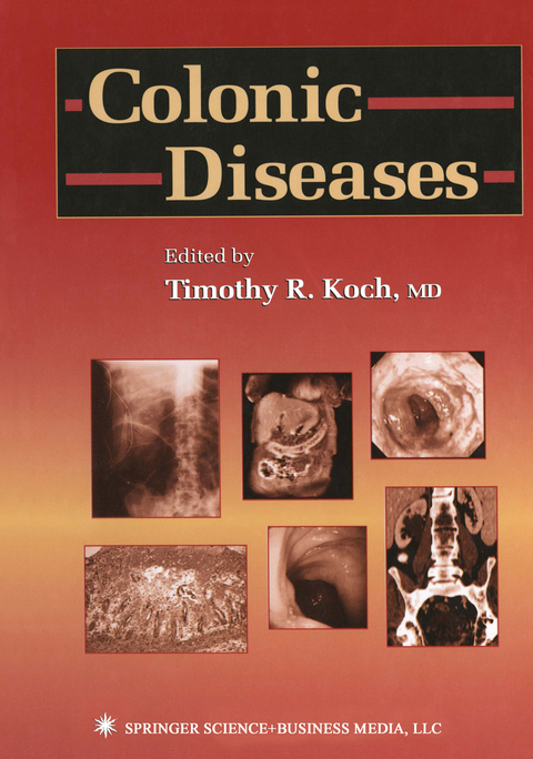 Colonic Diseases - 