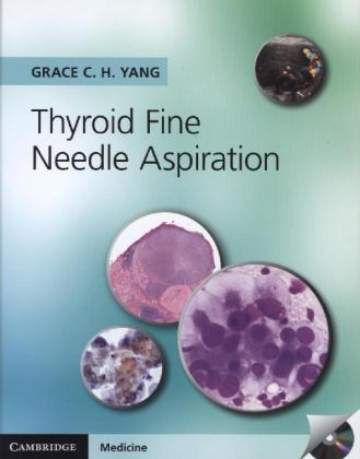 Thyroid Fine Needle Aspiration - Grace C. H. Yang
