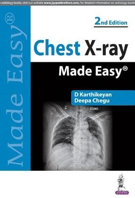 Chest X-ray Made Easy - D. Karthikeyan, Deepa Chegu