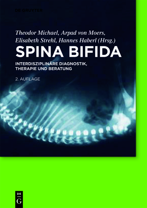 Spina bifida - 