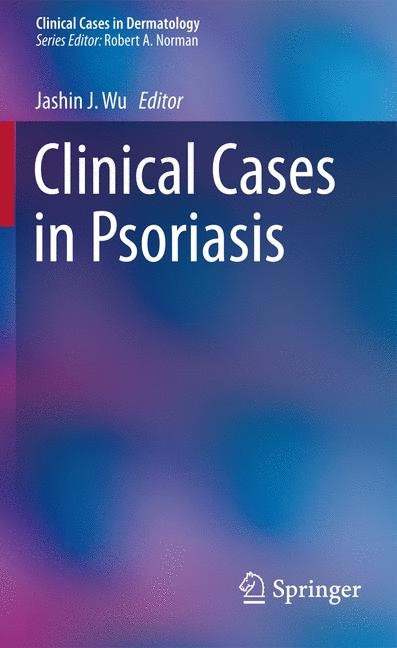 Clinical Cases in Psoriasis - 