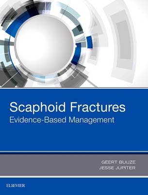 Scaphoid Fractures - Geert Alexander Buijze, Jesse B. Jupiter