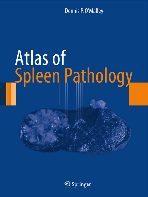 Atlas of Spleen Pathology - Dennis P. O'Malley