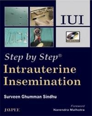 Step by Step: Intrauterine Insemination - Surveen Ghummann Sindhu