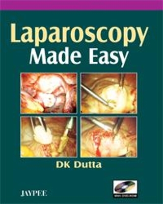 Laparoscopy Made Easy - DK Dutta