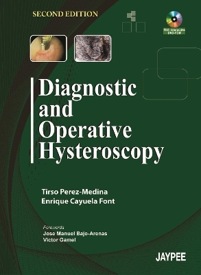 Diagnostic and Operative Hysteroscopy - Tirso Perez-Medina, Enrique Cayuela Font