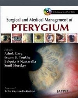 Surgical and Medical Management of Pterygium - Ashok Garg, Essam El Toukhy, Belquiz A Nassaralla, Sunil Moreker